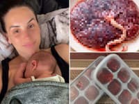 Šokujúci krok Weiterovej po pôrode: Uff, na toto by máloktorá mala žalúdok!