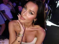 Bianka Rumanová s novým nosom. 