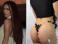 Šokujúci krok známej Slovenky: Nechala si vyplniť zadok! FOTO Z tej ceny sa vám zatočí hlava