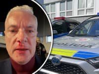 ZVRAT v prípade dobitého Ferenčáka: Prečo to dlhé čakanie na hliadku? Polícia vysvetlila, kde bola!