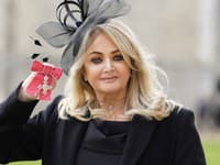 Legendárna speváčka po vážnej operácii: Stav sa jej náhle zhoršil... Skončila v kóme!