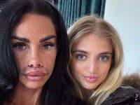 Katie Price musela pod nôž po tom, čo sa jej rozutekala výplň z pier do tváre. 