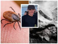 Hororový sled udalostí po tom, ako chlapca uhryzol kliešť: Stačil už len jediný krok a dostavila sa SMRŤ!