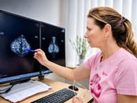 Na mamografiu už žena nemusí ísť so žiadankou od gynekológa: Cesta k prevencii sa zjednodušila