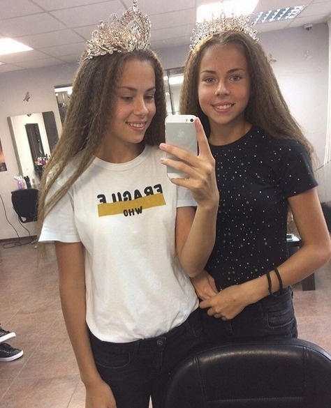 Pohľad na dvojičky (14) z Ruska trhá srdce: Chceli byť model