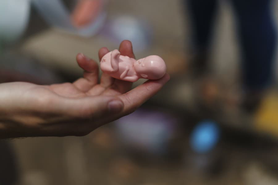 Na snímke členka skupiny proti potratom drží model plodu v 12. týždni tehotenstva, ktorý rozdávajú pacientkám prichádzajúcim na potraty na klinike plánovaného rodičovstva v Kolumbii.