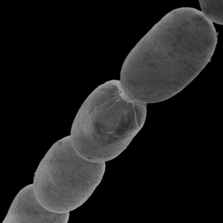 Toto je doposiaľ najväčšia objavená baktéria na svete.