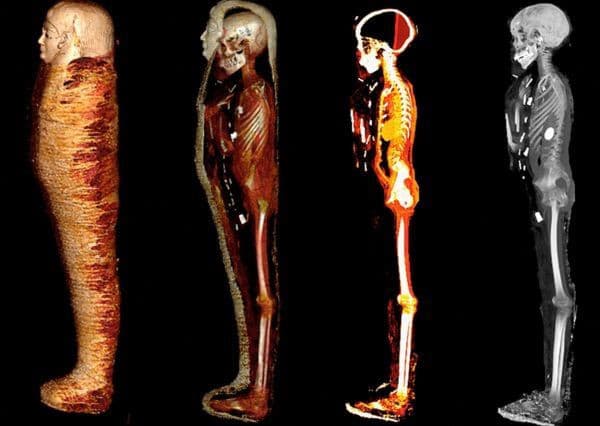 Vedci skenovali múmiu tínedžera