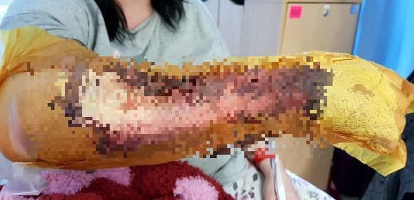 Ženu (43) napadol kamarátkin