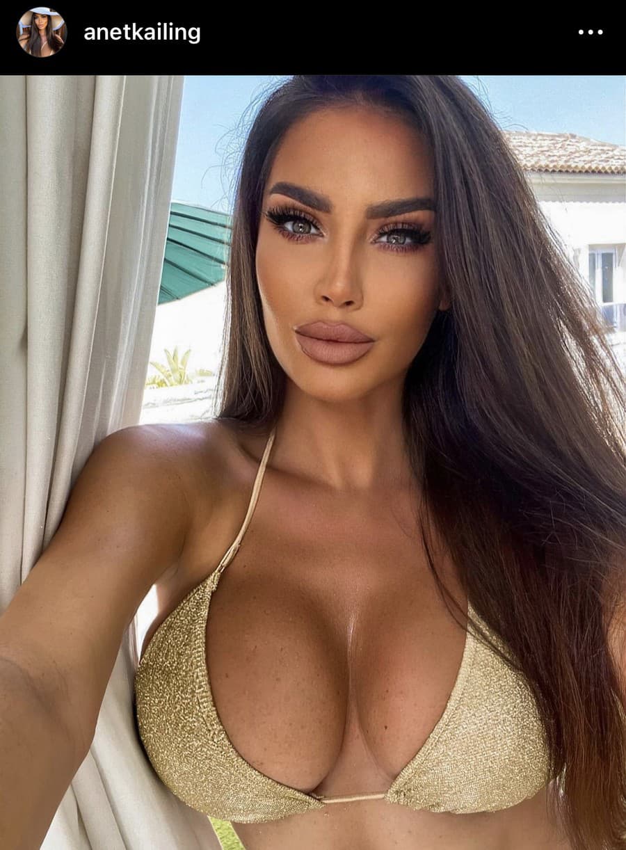 Slovenská Miss po 19 rokoch: Kedysi prirodzená KRÁSA a dnes… TOTÁLNA  UMELINA! - galéria | Topky.sk