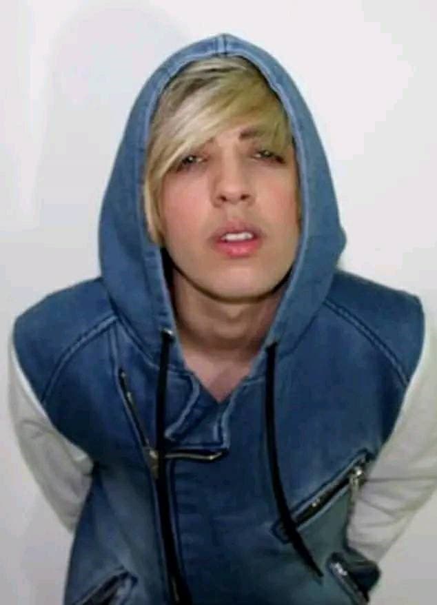  Saint Von Colucci pred plastickými operáciami.