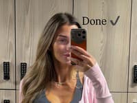 Natália Végh podstúpila estetický zákrok. 