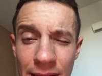 Herec Tomáš Sitkey akoby zázrakom vyviazol bez trvalých následkov.
