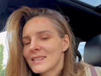 Herečka Monika Szabó nastupuje na liečbu svojej pleti. 