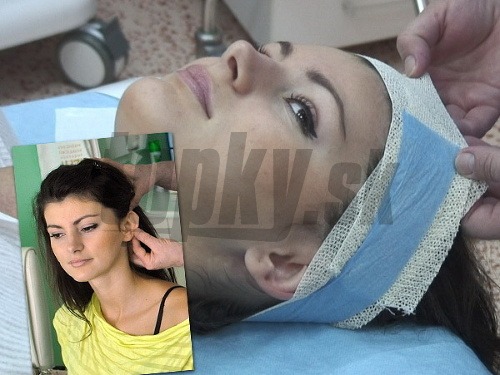 Miss Universe SR 2011 Kolesárová podstúpila operáciu odstávajúcich uší.