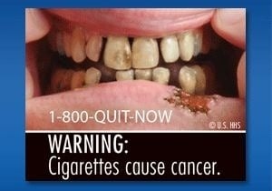 Varovanie: Cigarety spôsobujú rakovinu
