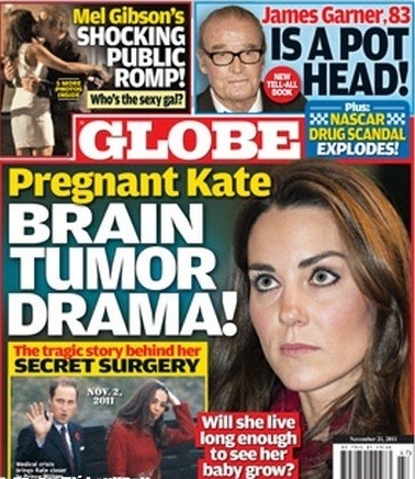 Podľa zahraničného plátku vojvodkyňa z Cambridge trpí vážnym ochorením mozgu.