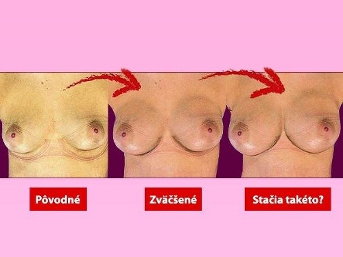 Na základe novej technológie sa budú môcť ženy rozhodnúť, aké veľké prsia chcú