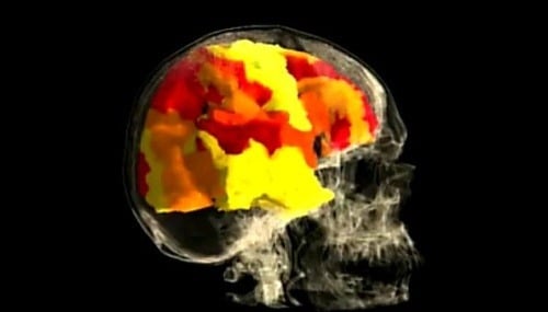 Snímok zachytáva mozog počas orgazmu
