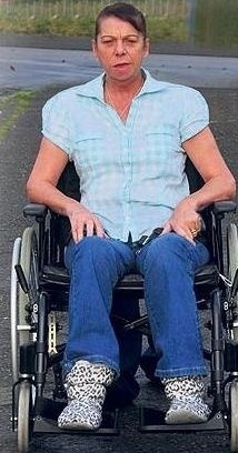 Fiona Wattová musí používať vozíček