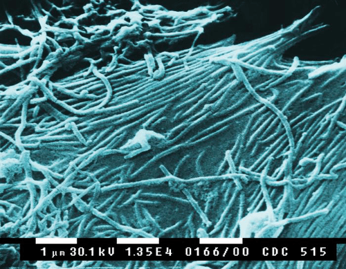 Vírus eboly