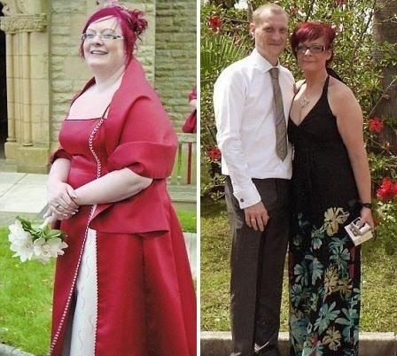Suzanne pred a po schudnutí