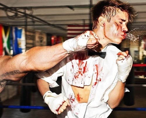 Justin Bieber sa pred objektívom nechal zmlátiť do krvi.