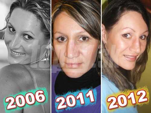 Zľava: Katarína v roku 2006, kedy mala ešte svoj nos. Na fotografii z 2011 je po niekoľkých zlomeninách nosa. Záber zo súčasnosti je oproti minulému roku výrazným krokom vpred.