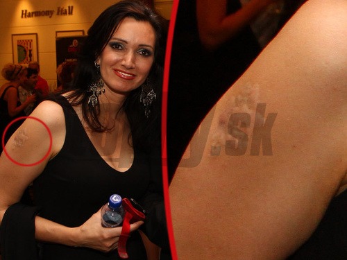 Karin sa pokúšala make-upom zamaskovať túto jazvu po tetovaní, no veľmi jej to nevyšlo. 