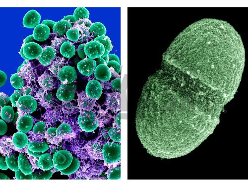 V tele zdravého človeka žije 10.000 druhov mikróbov