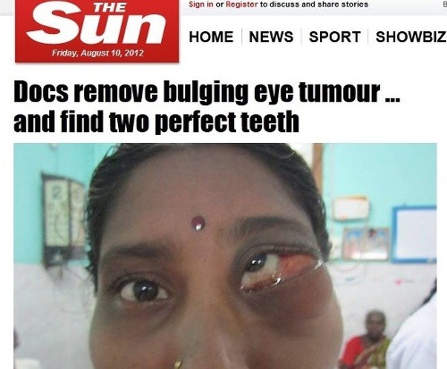 Lekári už zrak dievčine nedokázali zachrániť