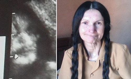 Tvár na ultrazvuku sa vraj podobá na túto mŕtvu ženu.