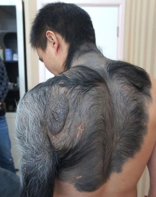 Zhangovo rameno, chrbát a časť hrude sú pokryté srsťou