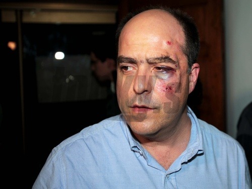 Poslanec Julio Borges objavil so zakrvavenou tvárou 