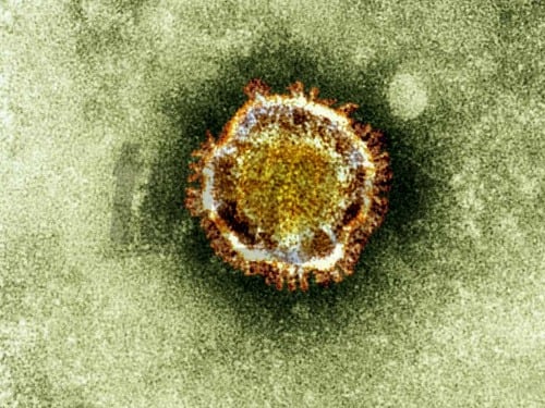 Koronavírus je podobný vírusu SARS