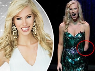 Nicole Kelly sa narodila bez ľavého predlaktia, no napriek životnému hendikepu v sobotu triumfovala na Miss Iowa 2013.