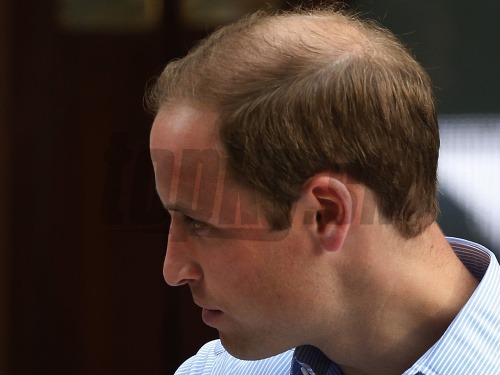 Princovi Williamovi vlasy ubúdajú rýchlym tempom.