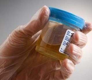 Liečba močom: Na akom princípe funguje a v čom vám môže pomôcť?