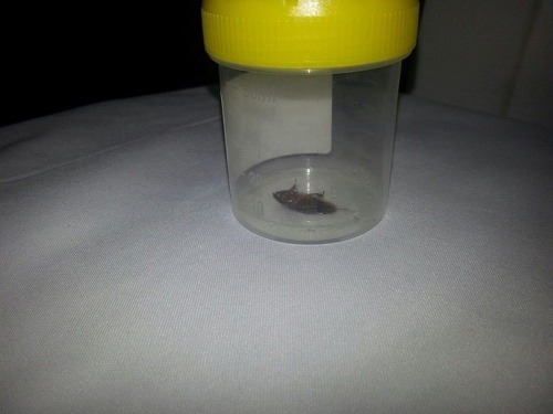 Lekárka vytiahla z ucha pacienta dvojcentimetrového žijúceho švába