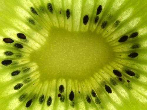 Kivi je zdravé ovocie, na ktoré by ste nemali zabúdať!