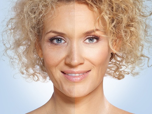 9 z 10 žien vyzerá o 10 rokov mladšie už po 4-týždňovej kúre Marie Lagrend.