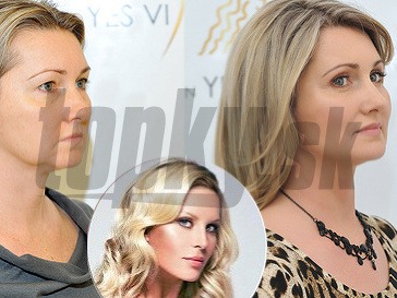 Ilustračný obrázok