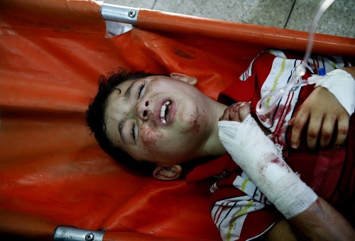Zranené palestínske deti po bombardovaní školy OSN