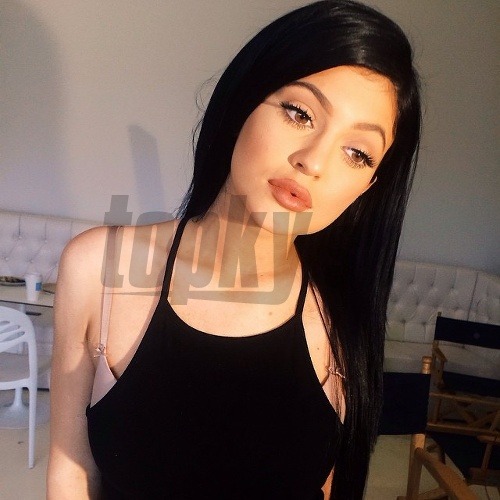 Kylie Jenner napriek veľmi mladému veku pravidelne podstupuje kozmetické vylepšenia tváre a rôzne výplne.