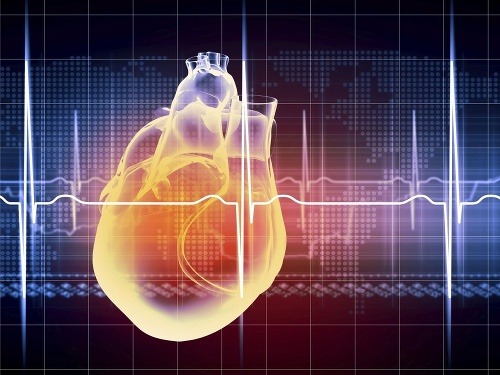 Test na naklonenej rovine 