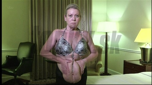 Tina Malone zhodila viac než 70 kíl, no zostala jej prebytočná koža a zdeformované prsia.