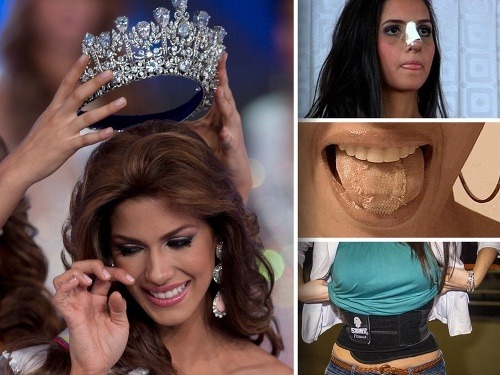 Dievčatá z Venezuely sú kvôli titulu kráľovnej krásy  ochotné podstúpiť aj brutálne a bolestivé praktiky. 