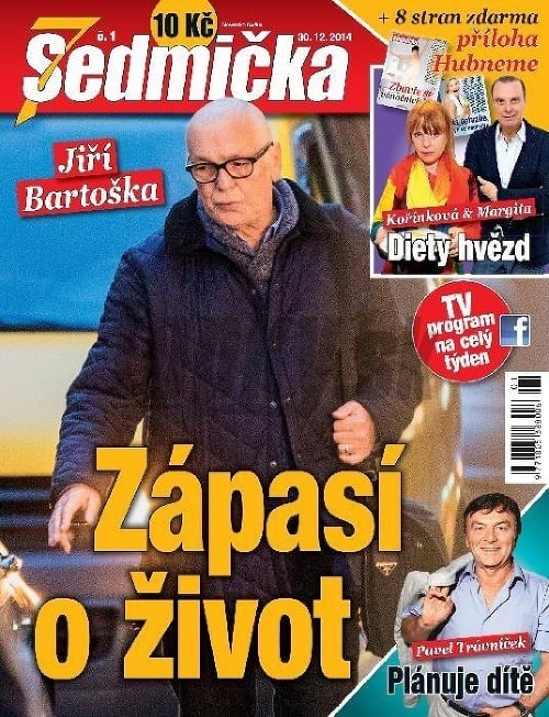 Chemoterapie pripravili Jiřího Bartošku o vlasy. 