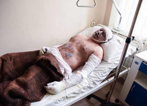 Výbuch v bani v ukrajinskom meste Doneck si vyžiadal viacero obetí