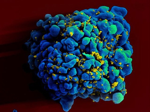 Vírus HIV